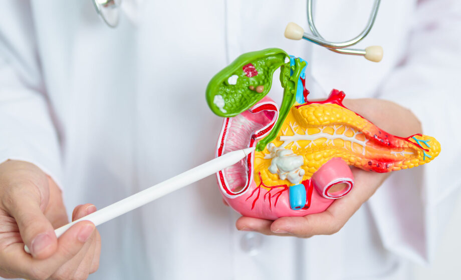 Calcoli alla colecisti Policlinico Abano