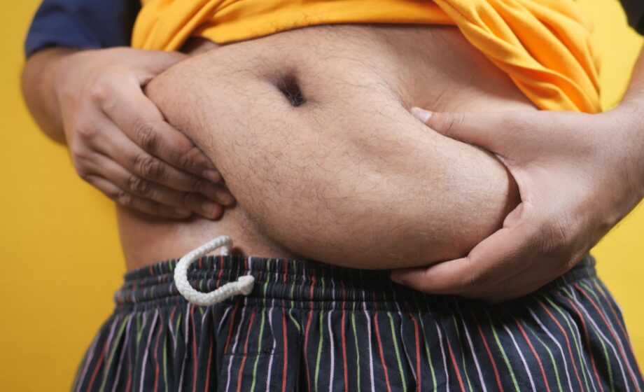 Dettaglio della pancia di una persona visibilmente obesa, mentre tiene la pancia tra le mani, in attesa di un trattamento per la sindrome metabolica