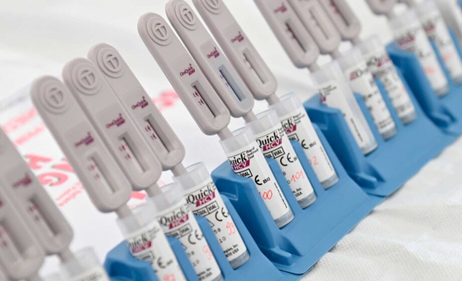 test gratuiti hiv, epatite b e c per le domeniche del cuore